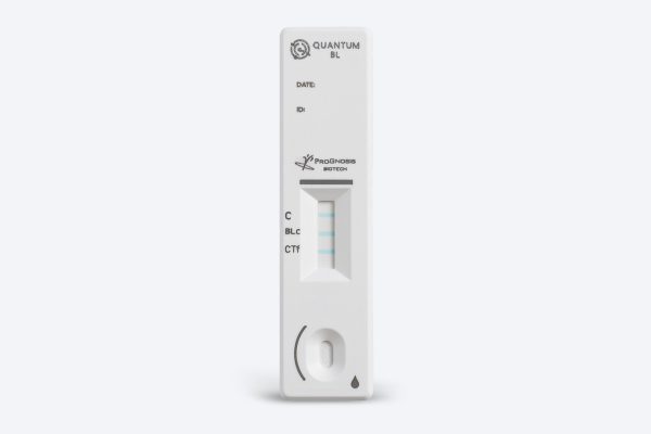 Prognosis Biotech Quantum BL -  β-lactams antibiotics in raw cow’s and goat’s milk LFD Test Kit - Acorn Scientific