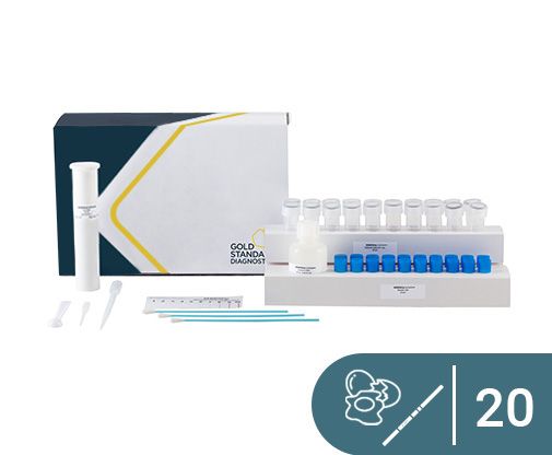 Gold Standard Diagnostics SENSIStrip Lysozyme - Acorn Scientific